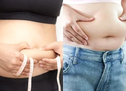 Mối liên hệ giữa đường hóa và chứng béo phì