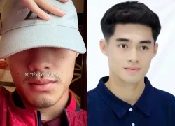 Tình hình của thủ môn Trung Kiên