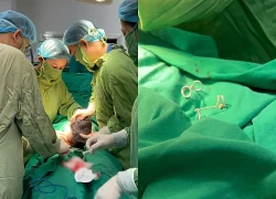 Em bé chào đời với 'đôi cánh' trên lưng