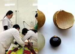 Cấp cứu bé trai hơn 2 tuổi hóc hạt nhãn, ngừng thở khi vào viện