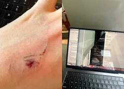 Ngồi cà phê ở TP.HCM, cô gái bị ván gỗ rơi trúng đầu, hỏng laptop