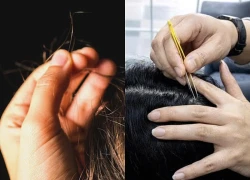 Hậu quả của việc nhổ tóc thường xuyên