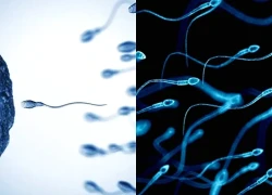 Sự thật phía sau cuộc đua tinh trùng khác xa nhiều người nghĩ