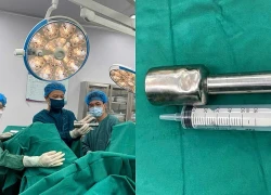 Thiếu niên 15 tuổi vào viện khẩn cấp vì chiếc chày 18 cm trong hậu môn