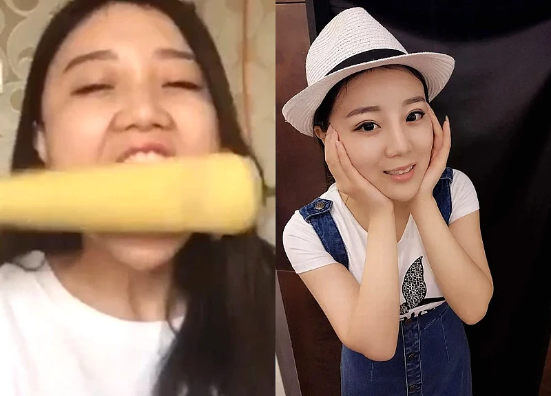 Cuộc sống sang chảnh hiện tại của "cô gái bị hói một mảng đầu vì ăn ngô bằng khoan" 10 năm trước