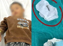 Bé trai 6 tuổi nuốt ốc vít sắt vào ổ bụng