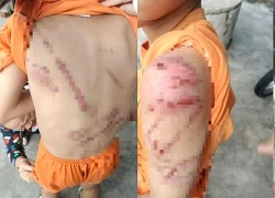 Dùng roi mây đánh con trai bầm tím cơ thể, người cha bị phạt 7,5 triệu đồng