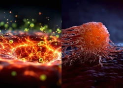 Dùng vi khuẩn để "ăn" khối u từ bên trong