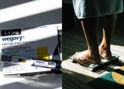 Người phụ nữ giảm 27kg rồi tăng lại: Lý do đến từ thuốc giảm cân?