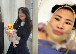 Thơ Nguyễn mới sinh con được 45 ngày đã lén đi thẩm mỹ, mặt biến dạng