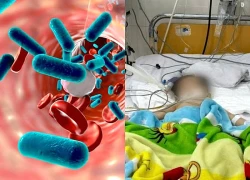 Bé trai sốc nhiễm khuẩn, suy thận cấp sau khi uống sữa hộp pha sẵn