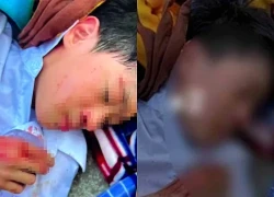 Công an thông tin vụ nam sinh lớp 6 bị bạn học đánh hội đồng