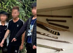 Thiếu niên 15 tuổi bị 3 người đánh bằng gậy sắt gây dập não, lún xương sọ