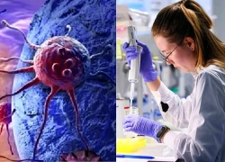 Nga tạo virus “không tồn tại trong tự nhiên” có thể tiêu diệt tế bào ung thư?