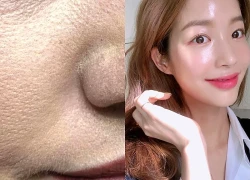 Vì sao mặt mốc trắng sau bôi kem chống nắng?