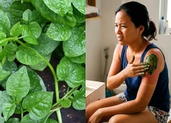 Da cháy nắng và cách dùng rau mồng tơi để xử lý