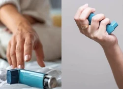 Triệu chứng thường gặp và các mức độ khó thở ở hen suyễn