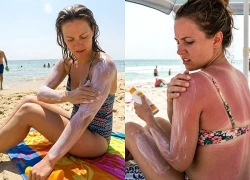 Sai lầm khi dùng kem chống nắng khiến da tệ hơn sau chuyến đi biển