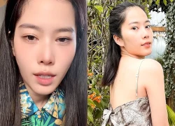 Tình hình sức khỏe hiện tại của Nam Em