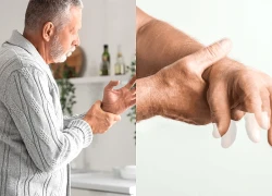 Cách làm chậm tiến triển bệnh Parkinson không dùng thuốc