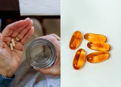Duy trì loại vitamin này ở tuổi trung niên giúp giảm đáng kể nguy cơ mắc Alzheimer