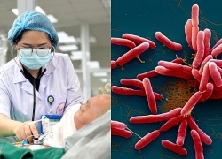 Hà Nội cảnh báo nguy cơ gia tăng bệnh Whitmore trong mùa mưa bão