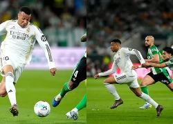 Mbappe kỷ niệm trận đấu thứ 100 cho Real Madrid bằng... chấn thương