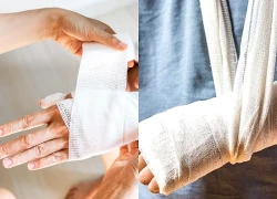 5 dấu hiệu nhận biết gãy xương, những cảnh báo sớm
