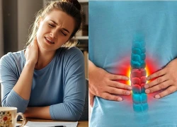 5 dấu hiệu cảnh báo cột sống đang "kêu cứu"
