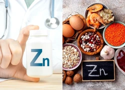 Bổ sung kẽm từ thực phẩm giúp giảm đau thần kinh tọa