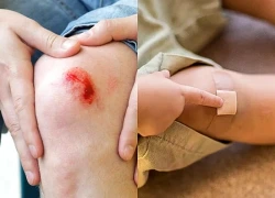 Điều xảy ra khi cơ thể thiếu kẽm
