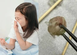 Bé gái 6 tuổi nhập viện khẩn cấp, bố mẹ "sốc" khi bác sĩ lấy ra thứ "đáng sợ" từ mũi con