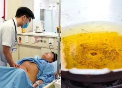 Người đàn ông 50 tuổi mắc ung thư gan, bác sĩ chỉ rõ "sai lầm chí mạng" khi dùng dầu ăn
