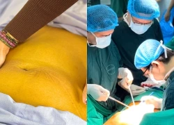 Người mắc viêm gan B sẽ rất nguy hiểm nếu tự ý làm điều này