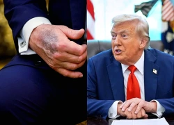 Nhà Trắng công bố báo cáo y tế, giải thích các vết bầm của Tổng thống Trump