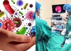 Nữ sinh 18 tuổi đau đầu suốt 3 năm vì chủ quan với viêm xoang mạn tính