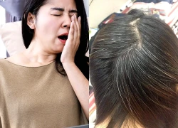 Tóc bạc sớm ở người trẻ ngày càng phổ biến: Chuyên gia cảnh báo nhiều nguyên nhân ít ai ngờ tới
