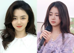 Đàm Tùng Vận gặp tai nạn nghiêm trọng khi quay phim, đôi môi gần như đứt lìa