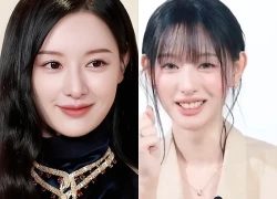 Không thể nhận ra Kim Ji Won nữa, gương mặt biến dạng hiện tại gây hoang mang tột độ