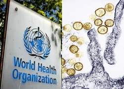 Virus Hanta: WHO kêu gọi Argentina xem xét lại việc rút khỏi tổ chức