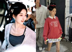 Sốc với clip nữ diễn viên đình đám lộ đôi chân gầy trơ xương, biến dạng đến mức lõm sâu