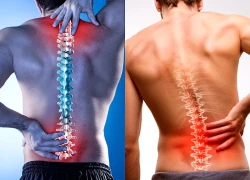 Nhiều người chưa 40 tuổi lưng đã "thẳng như cây tre"
