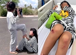 Nữ sinh lớp 6 tố bị nhóm bạn đánh hội đồng, bắt quỳ, lau chân