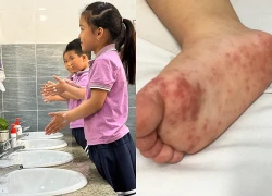 Trường học chủ động phòng, chống bệnh tay chân miệng
