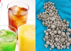 Bé trai 9 tuổi nhập viện khẩn cấp, bố mẹ "sốc" khi bác sĩ lấy ra thứ "đáng sợ" từ bụng con