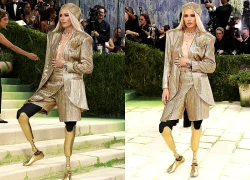 Nữ người mẫu bị cắt cụt chân, 14 năm sau mang chân giả đến đại náo Met Gala