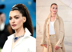 Anne Hathaway gần như bị mù mắt trái suốt 10 năm