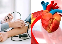 Biện pháp phòng ngừa bệnh tim mạch hiệu quả sau tuổi 30