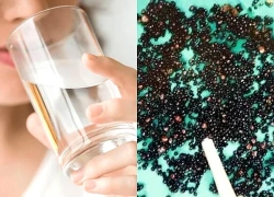Đau bụng suốt nhiều tháng, người đàn ông 43 tuổi sốc nặng khi bác sĩ gắp ra thứ "đáng sợ" trong bụng