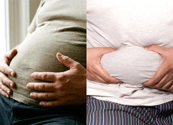 Dư thừa mỡ nội tạng gây nên những bệnh gì?